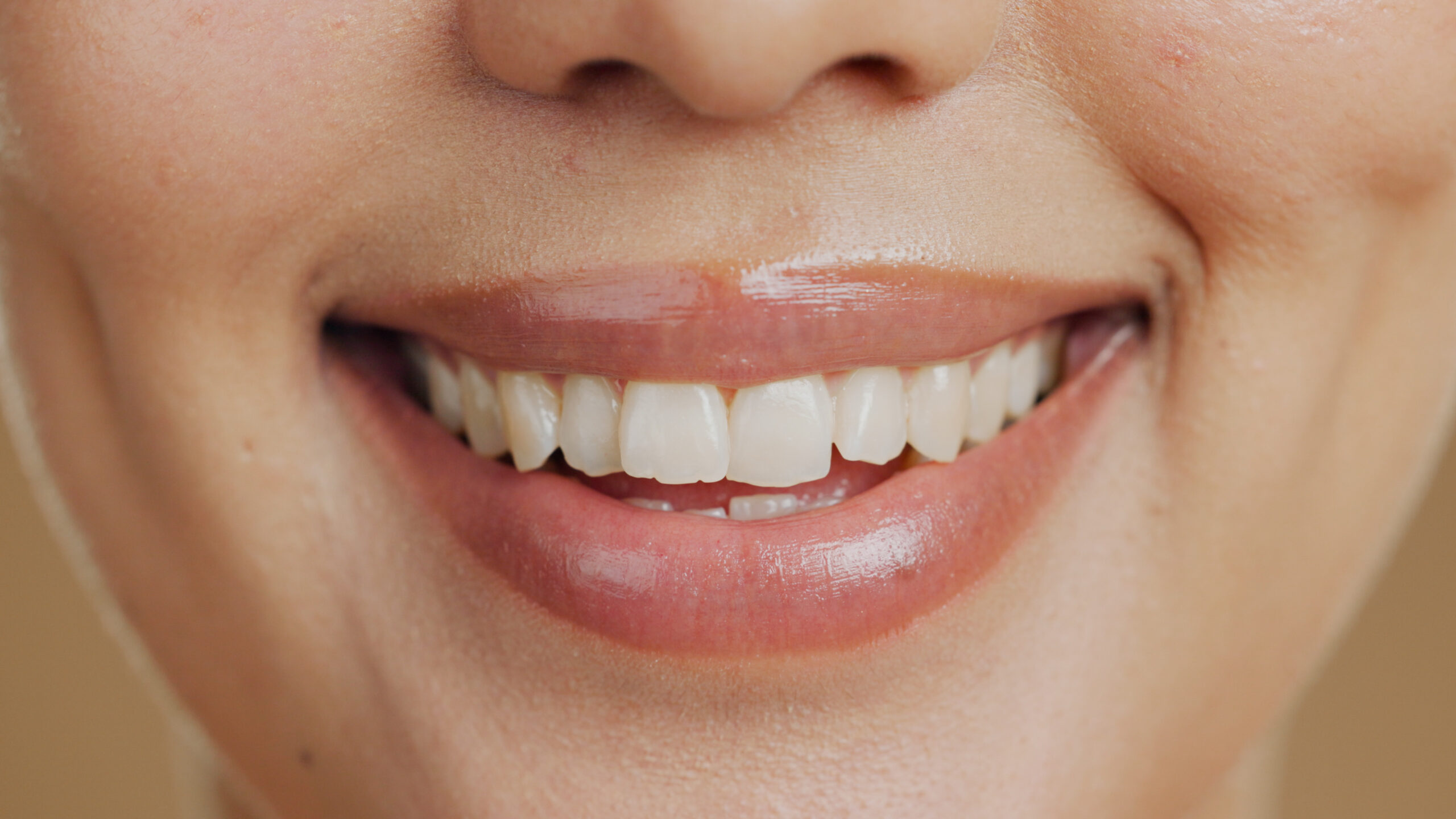 Beauty, dental and teeth with smile of woman for wellness, oral hygiene and self care. Health, conf.